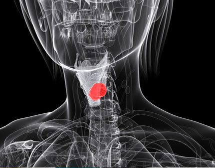 Oncologia de cara y cuello en Madrid