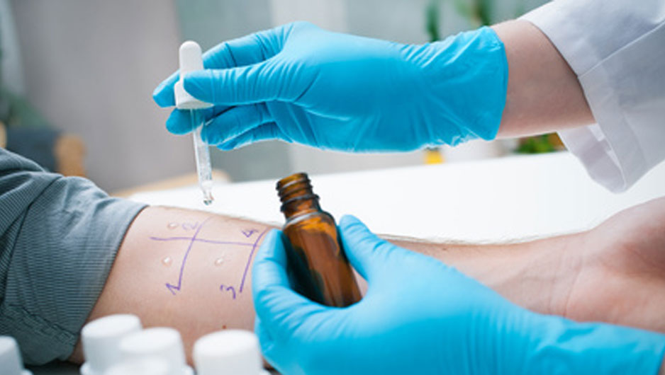 Pruebas de alergia en madrid